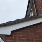 fascia repair